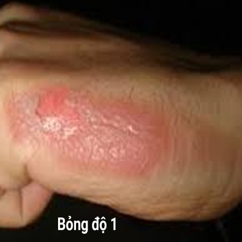 Forsancort Cream 15g