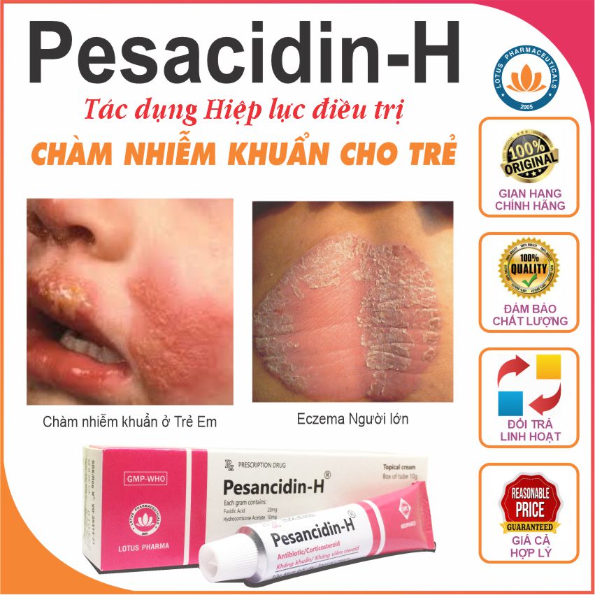 Pesancidin-H được chỉ định trong điều trị bệnh chàm và viêm da nhiễm trùng da cho trẻ em